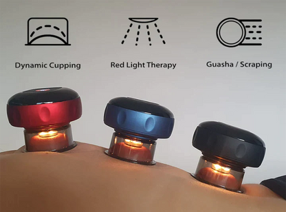 SmartCup – Smart Cupping Therapy Device
